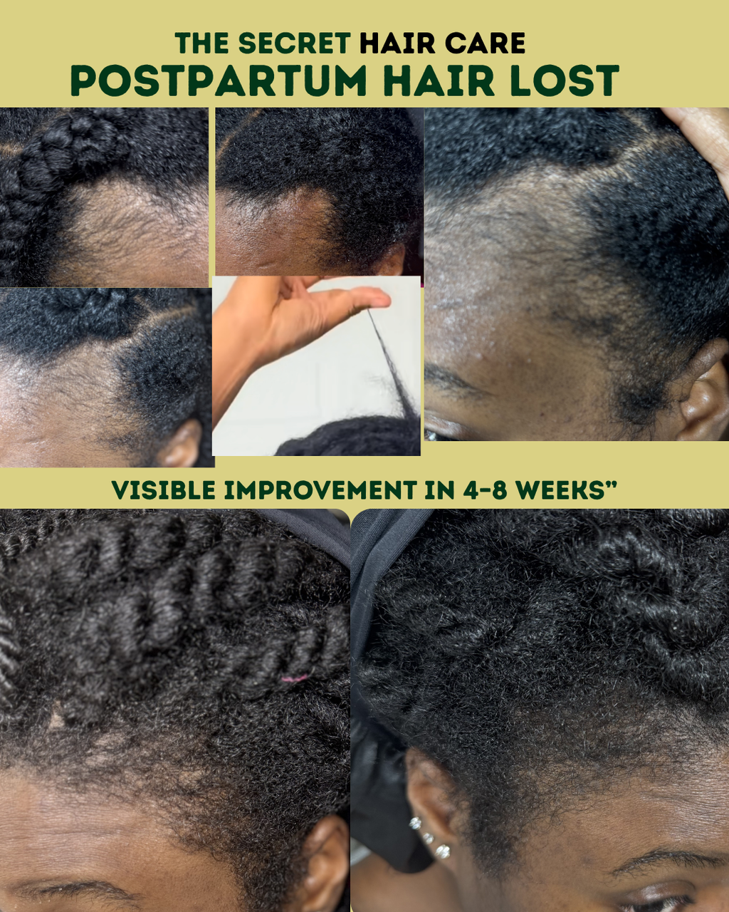 Growth oil & targeted Scalp Serum set