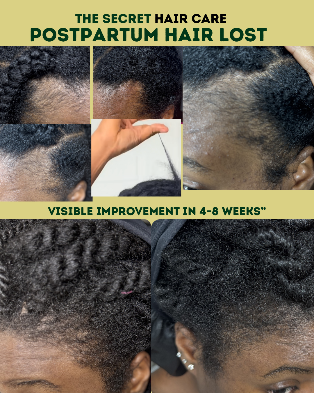Growth oil & targeted Scalp Serum set